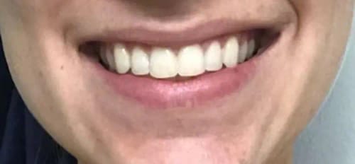 Pescuit cu AquaVision