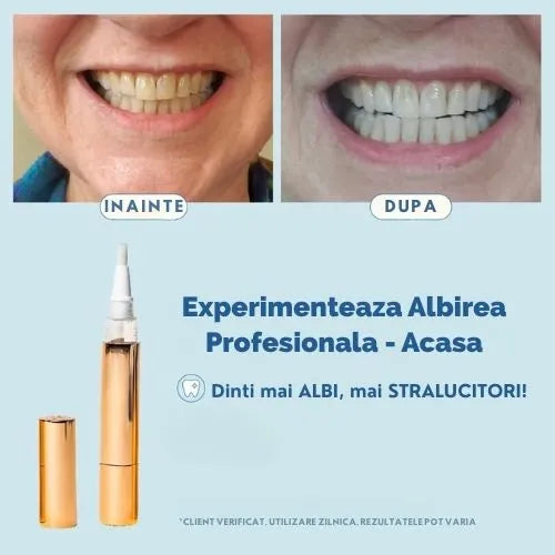 Stilou Albire Profesionala - Dentix™